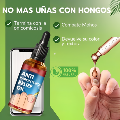 Tratamiento para eliminar Hongos de uña 100% Natural🍃